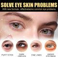 Retinol Eye Cream,Eye Cream for Dark Circles and Puffy Eyes,Anti-Age Eye Cream,Eye Cream for Wrinkles with Hyaluronic Acid and Caffeine,Anti-Wrinkle Eye Cream,Instant Wrinkle Remover for Men and Women